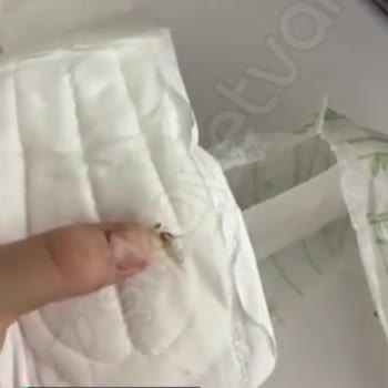 Molped Pedin İçinden Kahverengi Bir Şey Çıktı Sert