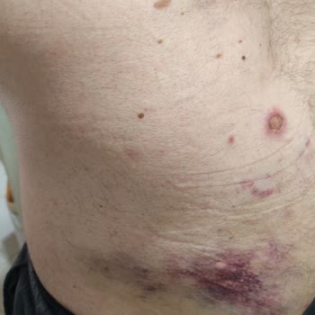 Gtos Terapi Vücut Sağlığını Tehdit Eden Hizmet