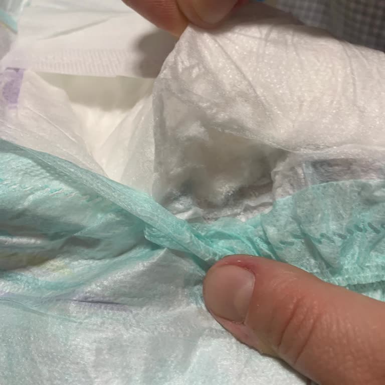 Bebek Bezlerindeki Sürekli Patlak Sorunu