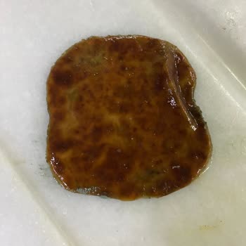 Küflü Ürün Şoku: Çocuklarımızın Sağlığı Tehlikede