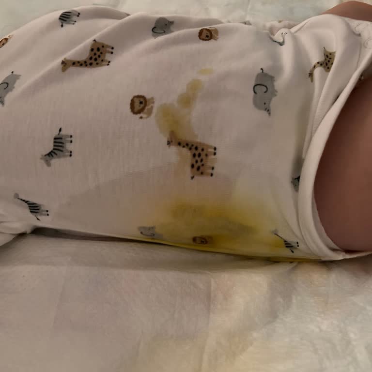 Prima Premium Bebek Bezi Sızıntı Sorunu