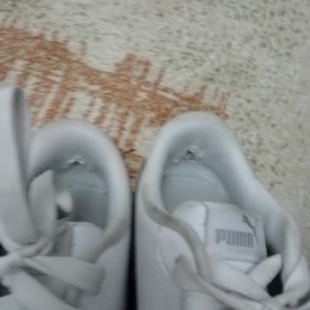 Puma Ayakkabının Arkası Yırtıldı, Açık Yara Oluştu