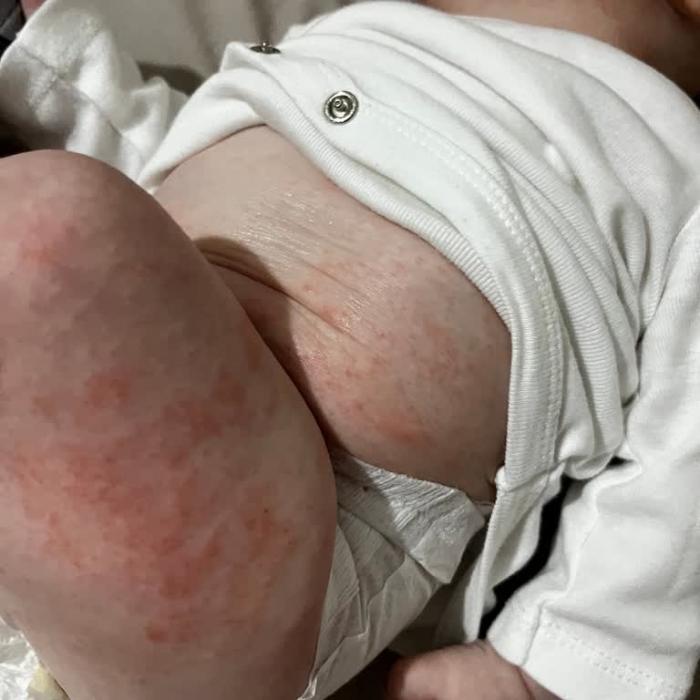 Bebek Cildine Zarar Veren Mustela Ürünleri