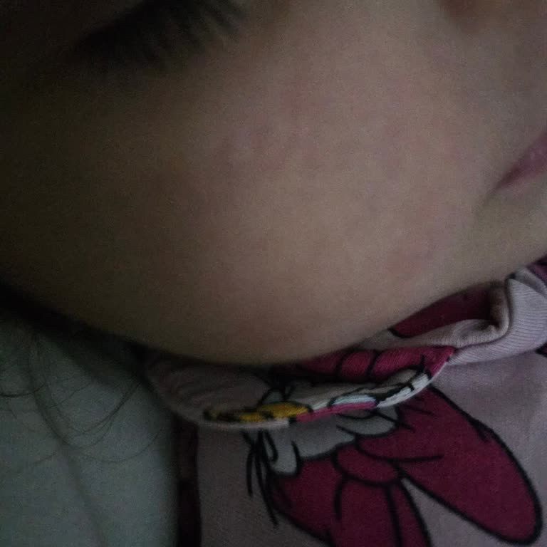 Bitkisel Ürün Tehlikesi: Çocuğumda Alerjik Reaksiyon