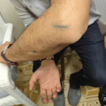 Doğum Günü Pastasında Beklenmedik Mavi Sürpriz