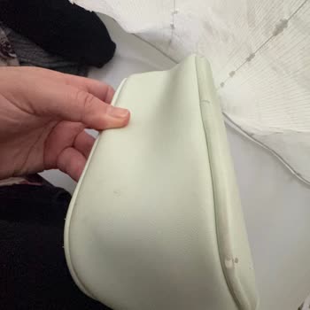 Ürünün Derisi Attı Ve Fermuar Sarardı