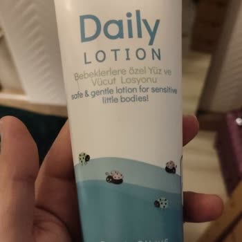 Bebek Losyonu Sonrası Ani Kızarıklık Ve Kaşıntı