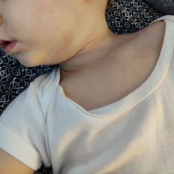 Bebek Losyonu Sonrası Ani Kızarıklık Ve Kaşıntı