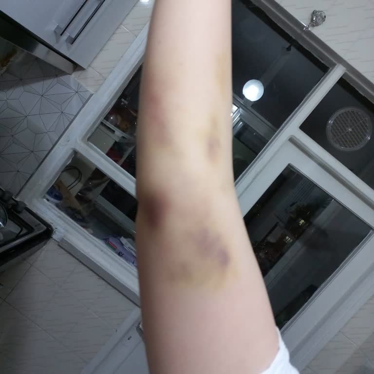 Tecrübesiz Hemşireler Yüzünden Yaşanan Sağlık Sorunu