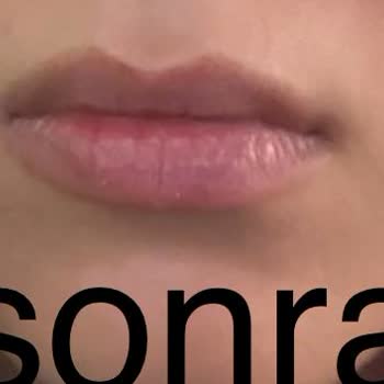 Dudak Dolgusu Deneyiminde Hayal Kırıklığı