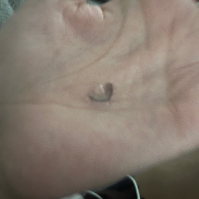 Dayanıklılığı Düşük Lens Sorunu