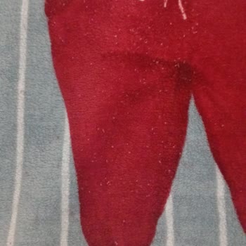 Battaniye Sorunu: Tüy Kabusu