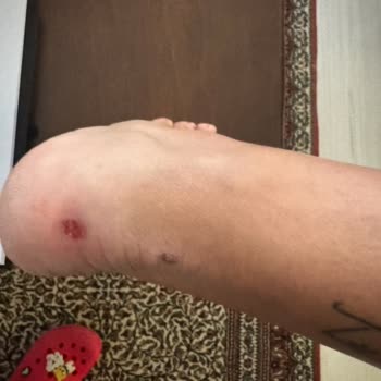 Derimod Botlarda Topuk Sorunu Ve İlgisizlik