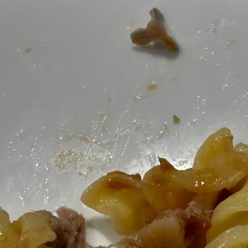 Ton Balığından Çıkan Kemik Şoku