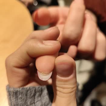 Protez Tırnakta Hayal Kırıklığı Ve Ekstra Ücret