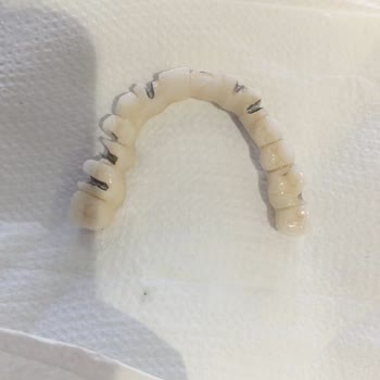 Sağlık Bakanlığı 3 Yıldır Çözülemeyen Diş Tedavisi Sorunu