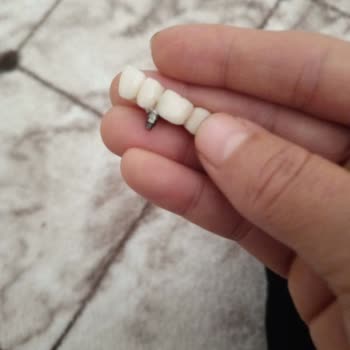 Sağlık Bakanlığı 3 Yıldır Çözülemeyen Diş Tedavisi Sorunu