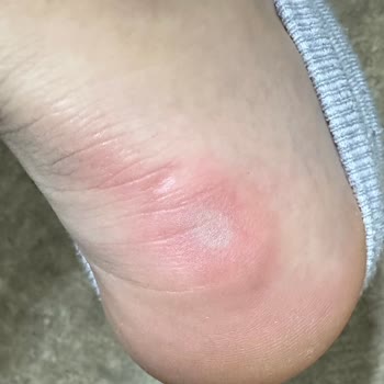 Salomon Shoes Deformed in 2 Months and Started Hitting My Heel