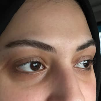 Kirpik Liftingi Deneyiminde Müşteri Memnuniyetsizliği