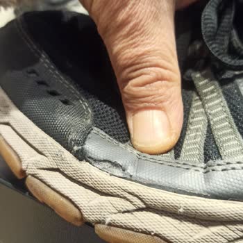 Skechers Ayakkabılarında Tekrarlayan Kalite Sorunları Ve Yetersiz Müşteri Hizmeti