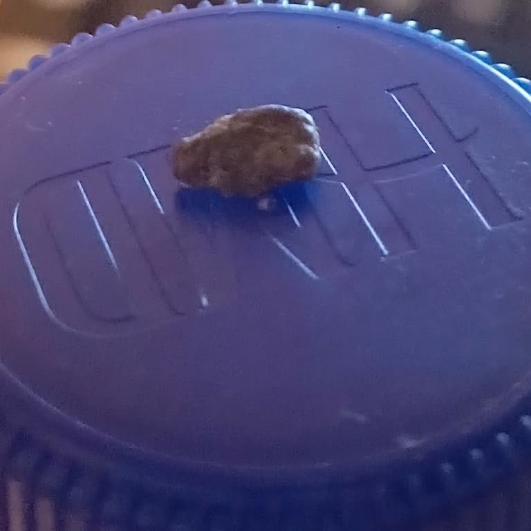 Tarım Kredi Kooperatif Market Taşlı Mercimek Skandalı: Dişim Kırıldı!