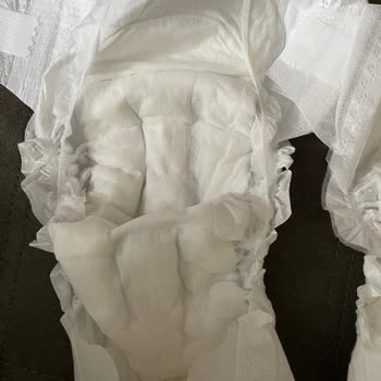 Sleepy Bezde Kalite Düşüşü Ve Cilt Sorunu