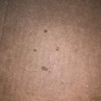 Domino's Pizzada Hijyen Sorunu Ve Eksik Sos