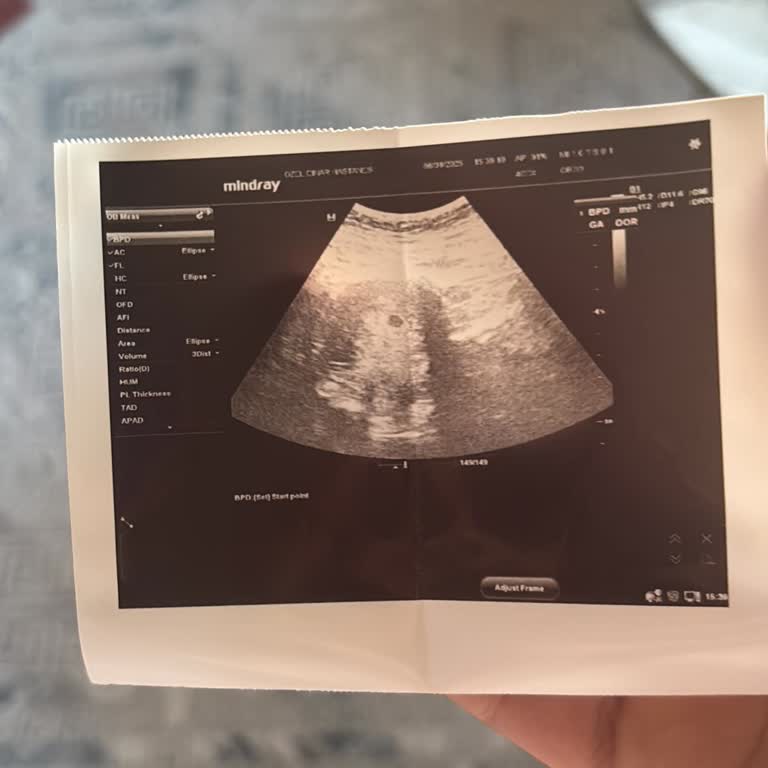 İlgisizlik Ve Yetersiz Yönlendirme Sonucu Kayıp