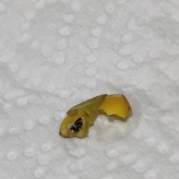 Organik Üründe Böcek Şoku: Bebeğim İçin Aldığım Mercimek Kullanılamaz Durumda