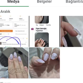 Hijyen Sorunu Ve Tehditler: Güzellik Merkezinde Kâbus Gibi Deneyim