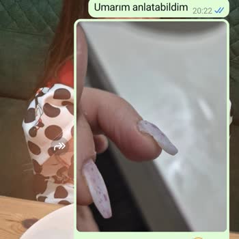 Hijyen Sorunu Ve Tehditler: Güzellik Merkezinde Kâbus Gibi Deneyim