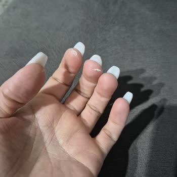 Hijyen Sorunu Ve Tehditler: Güzellik Merkezinde Kâbus Gibi Deneyim