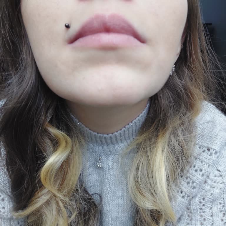 Burun Ameliyatı Hayal Kırıklığı