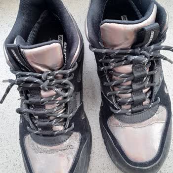 Skechers Ayakkabıda Beklenmedik Deformasyon