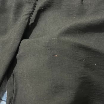 Pantolonun Hızla Sökülmesi Ve Yetersiz Müşteri Hizmeti