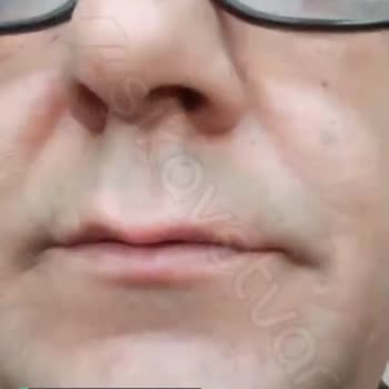 Youtube.com Üyeliğimi 2 Ay Deneme Ücretsiz Adı Altında Yanıltma!