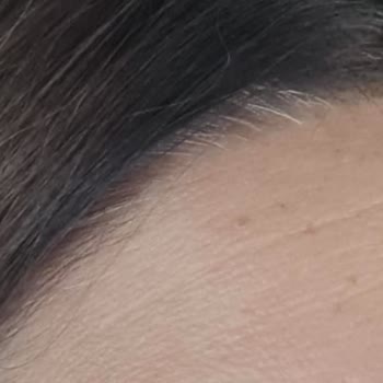 Kalitesiz Hizmet Ve Yanıltıcı Bilgilendirme