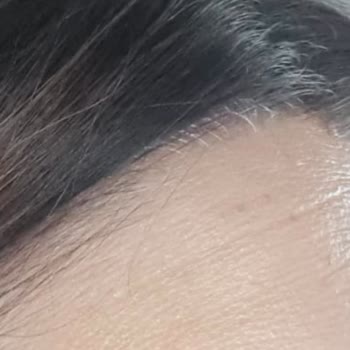 Kalitesiz Hizmet Ve Yanıltıcı Bilgilendirme