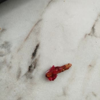 Eryaman Şubesi Lokumlarında Yabancı Cisim Şoku