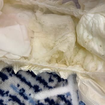 Sleepy Bezin Kalitesi Ve Sağlık Sorunları