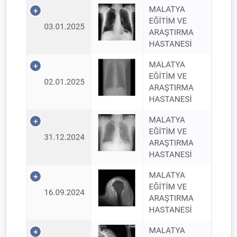 PET-CT Sonuçlarının Gecikmesi Hasta Yakınlarını Endişelendiriyor