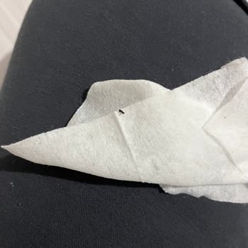 Bebek Ürününde Şok Edici İhmal!