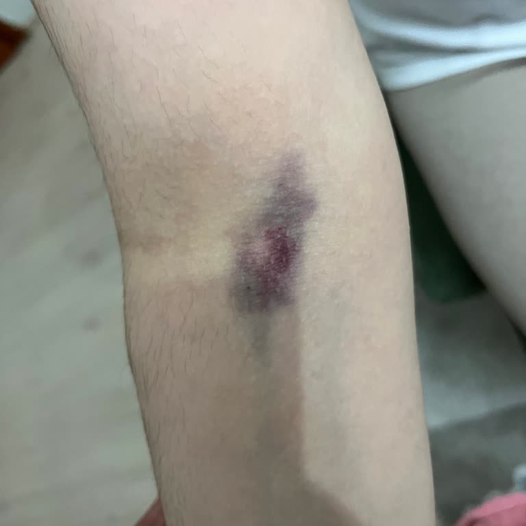 Kan Testi Sonuçlarında Yaşanan Belirsizlik Ve Yetersiz Hizmet