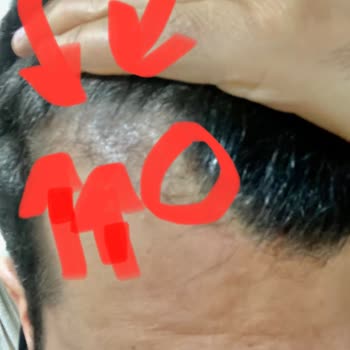 Kök Hücre Tedavisinde Hayal Kırıklığı Ve Etkisizlik