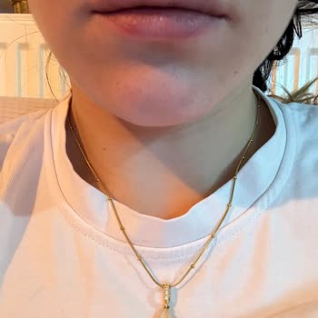 Dudak Dolgusu Kabusu: Kalıcılık Sıfır!