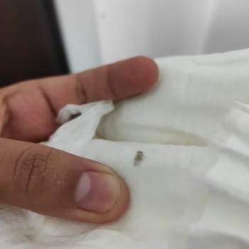 Bebe Bezi İçinde Yün Benzeri Madde Şoku