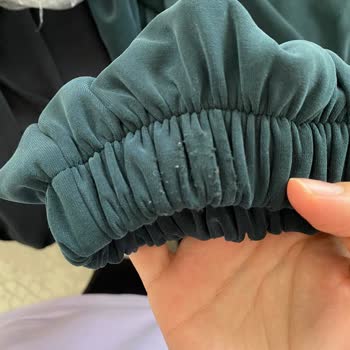 Şeyma Coşkun Deformeli Ürün Ve Yetersiz Müşteri Hizmeti