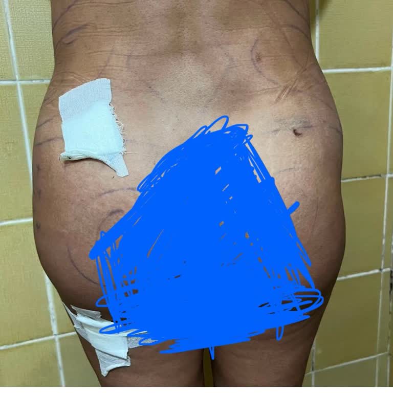 Ameliyat Sonrası Hayal Kırıklığı Ve Müşteri Memnuniyetsizliği