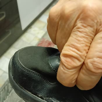 Skechers Dynamight Shoes Wore Out in One Winter – Requesting Resolution