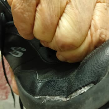 Skechers Dynamight Shoes Wore Out in One Winter – Requesting Resolution